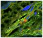Zika virus (ZIKV) inoculated frozen mouse placenta was stained with anti-flaviviruses and anti-cytokeratin. The DNA was stained with DAPI and mounted with Fluoromount-G<sup>®</sup> (SB Cat. No. 0100-01).<br/>Image from Vermillion MS, Lei J, Shabi Y, Baxter VK, Crilly NP, McLane M, et al. Intrauterine Zika virus infection of pregnant immunocompetent mice models transplacental transmission and adverse perinatal outcomes. Nat Commun. 2017;8:14575. Figure 4(b)<br/>Reproduced under the Creative Commons license https://creativecommons.org/licenses/by/4.0/