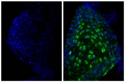 Frozen newborn mouse cartilage section was stained with Goat Anti-Type II Collagen-UNLB (SB Cat. No. 1320-01; right) followed by Donkey Anti-Goat IgG(H+L), Mouse/Rat SP ads-FITC (SB Cat. No. 6420-02) and DAPI.