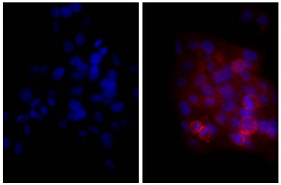 Human epithelial carcinoma cell line HEp-2 was stained with Mouse Anti-Human CD44-UNLB (SB Cat. No. 9400-01; right) followed by Goat Anti-Mouse Ig, Human ads-TXRD (SB Cat. No. 1010-07) and DAPI.