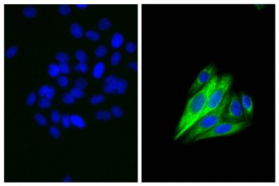 Human epithelial carcinoma cell line HEp-2 was stained with Mouse Anti-Cytokeratin 18-UNLB (SB Cat. No. 10085-01; right) followed by Goat Anti-Mouse IgG<sub>2b</sub>, Human ads-FITC (SB Cat. No. 1090-02) and DAPI.