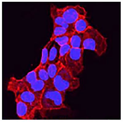 HCC827 cells were stained with anti-E-cadherin followed by a secondary antibody and mounted with DAPI Fluoromount-G<sup>&reg;</sup> (SB Cat. No. 0100-20).<br/>Image from Narita M, Shimura E, Nagasawa A, Aiuchi T, Suda Y, Hamada Y, et al. Chronic treatment of non-small-cell lung cancer cells with gefitinib leads to an epigenetic loss of epithelial properties associated with reductions in microRNA-155 and -200c. PLoS One. 2017;12(2):e0172115. Figure 4(e)<br/>Reproduced under the Creative Commons license https://creativecommons.org/licenses/by/4.0/