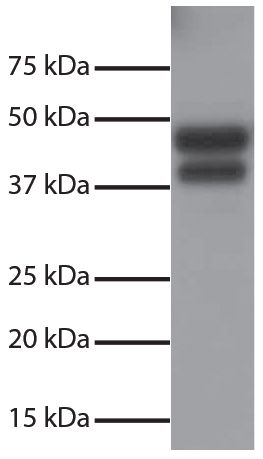 Total cell lysates from Jurkat cells were resolved by electrophoresis, transferred to PVDF membrane, and probed with Rabbit Anti-Human DR5-UNLB (SB Cat. No. 6600-01).  Proteins were visualized using Goat Anti-Rabbit IgG(H+L), Mouse/Human ads-HRP (SB Cat. No. 4050-05) secondary antibody and chemiluminescent detection.