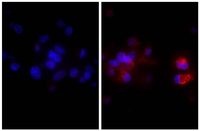 Human hepatocellular carcinoma cell line Hep G2 was stained with Rabbit IgG-UNLB isotype control  (SB Cat. No. 0111-01; left) and Rabbit Anti-Human DR5-UNLB (SB Cat. No. 6600-01; right) followed by Donkey Anti-Rabbit IgG(H+L), Mouse/Rat/Human SP ads-AF555 (SB Cat. No. 6440-32) and DAPI.