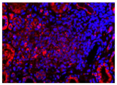 Paraffin embedded human kidney section from AAV patient was stained with anti-C5L2 followed by Goat Anti-Rabbit IgG(H+L), Mouse/Human ads-TRITC (SB Cat. No. 4050-03) and DAPI.<br/>Image from Yuan J, Gou S, Huang J, Hao J, Chen M, Zhao M. C5a and its receptors in human anti-neutrophil cytoplasmic antibody (ANCA)-associated vasculitis. Arthritis Res Ther. 2012;14:R140. Figure 3(c)<br/>Reproduced under the Creative Commons license https://creativecommons.org/licenses/by/2.0/