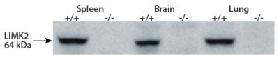 Spleen, brain, and lung tissues from wild type (+/+) and homozygous Limk2 (-/-) mutant mice were resolved by electrophoresis, transfered to PVDF membrane, and probed with anti-LIMK2 followed by Goat Anti-Rat IgG(H+L), Mouse ads-HRP (SB Cat. No. 3050-05) and chemiluminescent detection.<br/>Image from Rice DS, Hansen GM, Liu F, Crist MJ, Newhouse MM, Potter D, et al. Keratinocyte migration in the developing eyelid requires LIMK2. PLoS One. 2012;7(10):e47168. Figure 1(c)<br/>Reproduced under the Creative Commons Attribution License