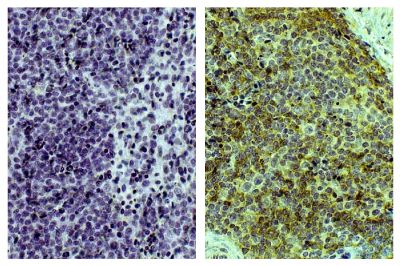 Paraffin embedded chicken spleen tissue was stained with Mouse Anti-Chicken Bu-1-UNLB (SB Cat. No. 8395-01; right) followed by Anti-Mouse IgG-HRP, DAB, and hematoxylin.