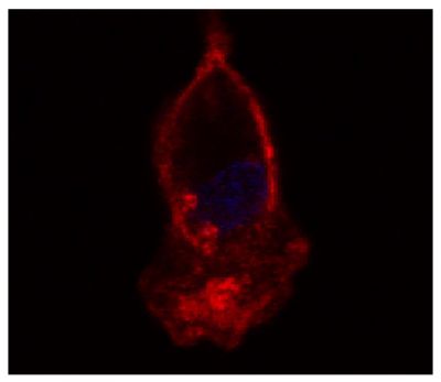 Hooded seal bronchoalveolar lavage cells were stained with Mouse Anti-Human CD14-UNLB (SB Cat. No. 9561-01) followed by a secondary antibody and DRAQ5.<br/>Image from Larsen AK, Nymo IH, Boysen P, Tryland M, Godfroid J. Entry and elimination of marine mammal Brucella spp. by hooded seal (<i>Cystophora cristata</i>) alveolar macrophages <i>in vitro</i>. PLoS One. 2013;8(7):e70186. Figure 3<br/>Reproduced under the Creative Commons Attribution License