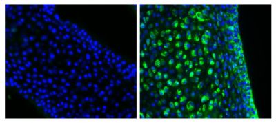 Frozen newborn mouse cartilage sections were blocked with Normal Rabbit Serum (SB Cat. No. 0040-01) and stained with Mouse Anti-Collagen Type II-UNLB (right) followed by Rabbit F(ab')<sub>2</sub> Anti-Mouse IgG(H+L), Human ads-BIOT (SB Cat. No. 6125-08), Streptavidin-FITC (SB Cat. No. 7100-02), DAPI, and mounted with Fluoromount-G<sup>&reg;</sup> Anti-Fade (SB Cat. No. 0100-35).