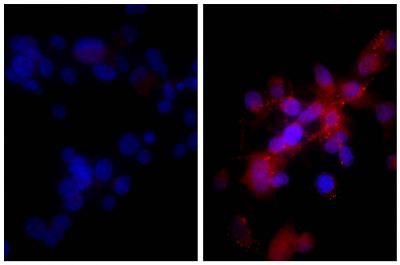 Human hepatocellular carcinoma cell line Hep G2 was stained with Rabbit IgG-UNLB isotype control (SB Cat. No. 0111-01; left) and Rabbit Anti-Human DR5-UNLB (SB Cat. No. 6600-01; right) followed by Donkey Anti-Rabbit IgG(H+L), Mouse/Rat/Human SP ads-BIOT (SB Cat. No. 6440-08, Streptavidin-CY3 (SB Cat. No. 7100-12), and DAPI.