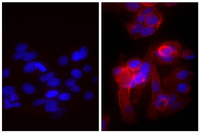 Human epithelial carcinoma cell line HEp-2 was stained with Mouse Anti-Human CD44-UNLB (SB Cat. No. 9400-01; right) followed by Goat Anti-Mouse IgG(H+L), Human ads-TRITC (SB Cat. No. 1031-03) and DAPI.