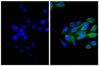 Human pancreatic carcinoma cell line MIA PaCa-2 was stained with Mouse Anti-Cytokeratin 18-UNLB (SB Cat. No. 10085-01; right) followed by Goat Anti-Mouse IgG(H+L), Multi-Species SP ads-BIOT (SB Cat. No. 1038-08), Streptavidin-FITC (SB Cat. No. 7100-02), and DAPI.