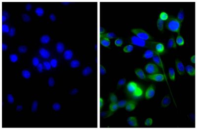 Human pancreatic carcinoma cell line MIA PaCa-2 was stained with Mouse Anti-Cytokeratin 18-UNLB (SB Cat. No. 10085-01; right) followed by Goat Anti-Mouse IgG(H+L), Multi-Species SP ads-AF488 (SB Cat. No. 1038-30) and DAPI.