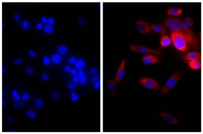 Human pancreatic carcinoma cell line MIA PaCa-2 was stained with Mouse Anti-Cytokeratin 18-UNLB (SB Cat. No. 10085-01; right) followed by Goat Anti-Mouse IgG(H+L), Multi-Species SP ads-AF555 (SB Cat. No. 1038-32) and DAPI.