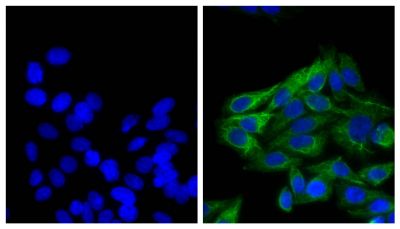 Human epithelial carcinoma cell line HEp-2 was stained with Mouse Anti-Cytokeratin 18-UNLB (SB Cat. No. 10085-01; right) followed by Goat Anti-Mouse IgG<sub>2b</sub>, Human ads-AF488 (SB Cat. No. 1090-30) and DAPI.