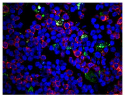Frozen piglet thymus section was stained with Mouse Anti-Porcine CD3ε-SPRD (SB Cat. No. 4510-13) and anti-LC3 followed by a secondary antibody and DAPI.<br/>Image from Wang G, Yu Y, Tu Y, Tong J, Liu Y, Zhang C, et al. Highly pathogenic porcine reproductive and respiratory syndrome virus infection induced apoptosis and autophagy in thymi of infected piglets. PLoS One. 2015;10(6):e0128292. Figure 4(a)<br/>Reproduced under the Creative Commons license https://creativecommons.org/licenses/by/4.0/