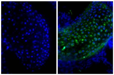 Frozen newborn mouse cartilage section was stained with Goat Anti-Type II Collagen-UNLB (SB Cat. No. 1320-01; right) followed by Donkey Anti-Goat IgG(H+L), Mouse/Rat SP ads-BIOT (SB Cat. No. 6420-08), Streptavidin-FITC (SB Cat. No. 7100-02), and DAPI.