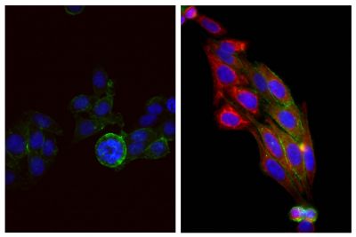 Human epithelial carcinoma cell line HEp-2 was stained with Mouse Anti-Cytokeratin 18-UNLB (SB Cat. No. 10085-01; right) and Mouse Anti-Human CD44-FITC (SB Cat. No. 9400-02) followed by Goat Anti-Mouse IgG<sub>2b</sub>, Human ads-AF555 (SB Cat. No. 1090-32) and DAPI.