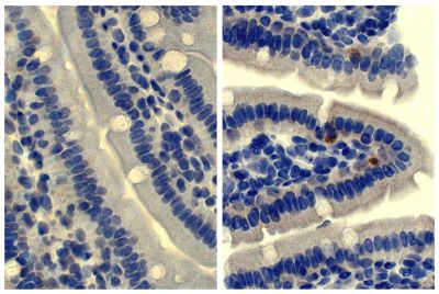 Paraffin embedded mouse small intestine section was stained with Rat Anti-Mouse IgD-UNLB (SB Cat. No. 1120-01; right) followed by an HRP conjugated secondary antibody, DAB, and hematoxylin.