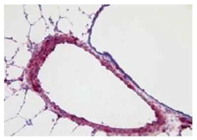 Frozen mouse lung tissue section following 21 days of hypoxia was stained with anti-S100A4 followed by Goat Anti-Rabbit IgG(H+L), Mouse/Human ads-UNLB (SB Cat. No. 4050-01) followed by an AP conjugated secondary antibody and a substrate for the detection of alkaline phosphatase.<br/>Image from Kwapiszewska G, Wilhelm J, Wolff S, Laumanns I, Koenig IR, Ziegler A, et al. Expression profiling of laser-microdissected intrapulmonary arteries in hypoxia-induced pulmonary hypertension. Respir Res. 2005;6:109. Figure 5(b)<br/>Reproduced under the Creative Commons license https://creativecommons.org/licenses/by/2.0/