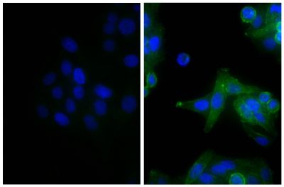 Human epithelial carcinoma cell line HEp-2 was stained with Mouse Anti-Human CD44-UNLB (SB Cat. No. 9400-01; right) followed by Goat Anti-Mouse IgG(H+L), Human ads-AF488 (SB Cat. No. 1031-30) and DAPI.