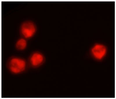 Wdpks1Δ-1 yeast cells treated with liquid nitrogen were stained with anti-melanin followed by Goat Anti-Mouse IgM, Human ads-TRITC (SB Cat. No. 1020-03).<br/>Image from Paolo WF Jr, Dadachova E, Mandal P, Casadevall A, Szaniszlo PJ, Nosanchuk JD. Effects of disrupting the polyketide synthase gene <i>WdPKS1</i> in <i>Wangiella</i> [<i>Exophiala</i>] <i>dermatitidis</i> on melanin production and resistance to killing by antifungal compounds, enzymatic degradation, and extremes in temperature. BMC Microbiol. 2006;6:55. Figure 5(d)<br/>Reproduced under the Creative Commons license https://creativecommons.org/licenses/by/2.0/