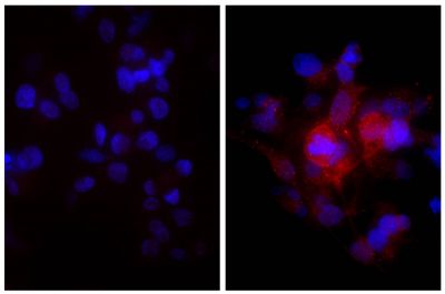 Human hepatocellular carcinoma cell line Hep G2 was stained with Rabbit Anti-Human DR5-UNLB (SB Cat. No. 6600-01; right) and Rabbit IgG-UNLB (SB Cat. No. 0111-01; left) followed by Donkey F(ab')<sub>2</sub> Anti-Rabbit IgG(H+L), Mouse/Rat/Human SP ads-AF555 (SB Cat. No. 6442-32) and DAPI.