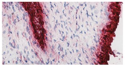 Frozen human synovial tissue section from patient with osteoarthritis was stained with hematoxylin and eosin and Mouse Anti-Human CD55-UNLB (SB Cat. No. 9661-01) followed by a secondary antibody and colorimetric substrate.<br/>Image from Mucke J, Hoyer A, Brinks R, Bleck E, Pauly T, Schneider M, et al. Inhomogeneity of immune cell composition in the synovial sublining: linear mixed modelling indicates differences in distribution and spatial decline of CD68+ macrophages in osteoarthritis and rheumatoid arthritis. Arthritis Res Ther. 2016;18:170. Figure 1<br/>Reproduced under the Creative Commons license https://creativecommons.org/licenses/by/4.0/