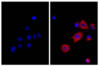 Human pancreatic carcinoma cell line MIA PaCa-2 was stained with Mouse Anti-Cytokeratin 18-UNLB (SB Cat. No. 10085-01; right) followed by Rat Anti-Mouse IgG<sub>2b</sub>-BIOT (SB Cat. No. 1186-08), Streptavidin-CY3 (SB Cat. No. 7100-12), and DAPI.