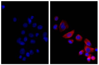 Human pancreatic carcinoma cell line MIA PaCa-2 was stained with Mouse Anti-Cytokeratin 18-UNLB (SB Cat. No. 10085-01; right) followed by Donkey Anti-Mouse IgG(H+L), Multi-Species SP ads-AF555 (SB Cat. No. 6415-32) and DAPI.