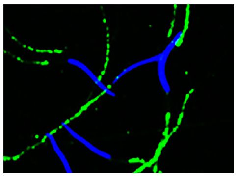 Chicken sperm was stained with anti-CaMKIV followed by Goat Anti-Rabbit IgG(H+L), Mouse/Human ads-BIOT (SB Cat. No. 4050-08), Streptavidin-CY2 (SB Cat. No. 7100-21), and DAPI.<br/>Image from Nguyen TM, Combarnous Y, Praud C, Duittoz A, Blesbois E. Ca<sup>2+</sup>/calmodulin-dependent protein kinase kinases (CaMKKs) effects on AMP-activated protein kinase (AMPK) regulation of chicken sperm functions. PLoS One. 2016;11(1):e0147559. Figure 4(f)<br/>Reproduced under the Creative Commons license https://creativecommons.org/licenses/by/4.0/