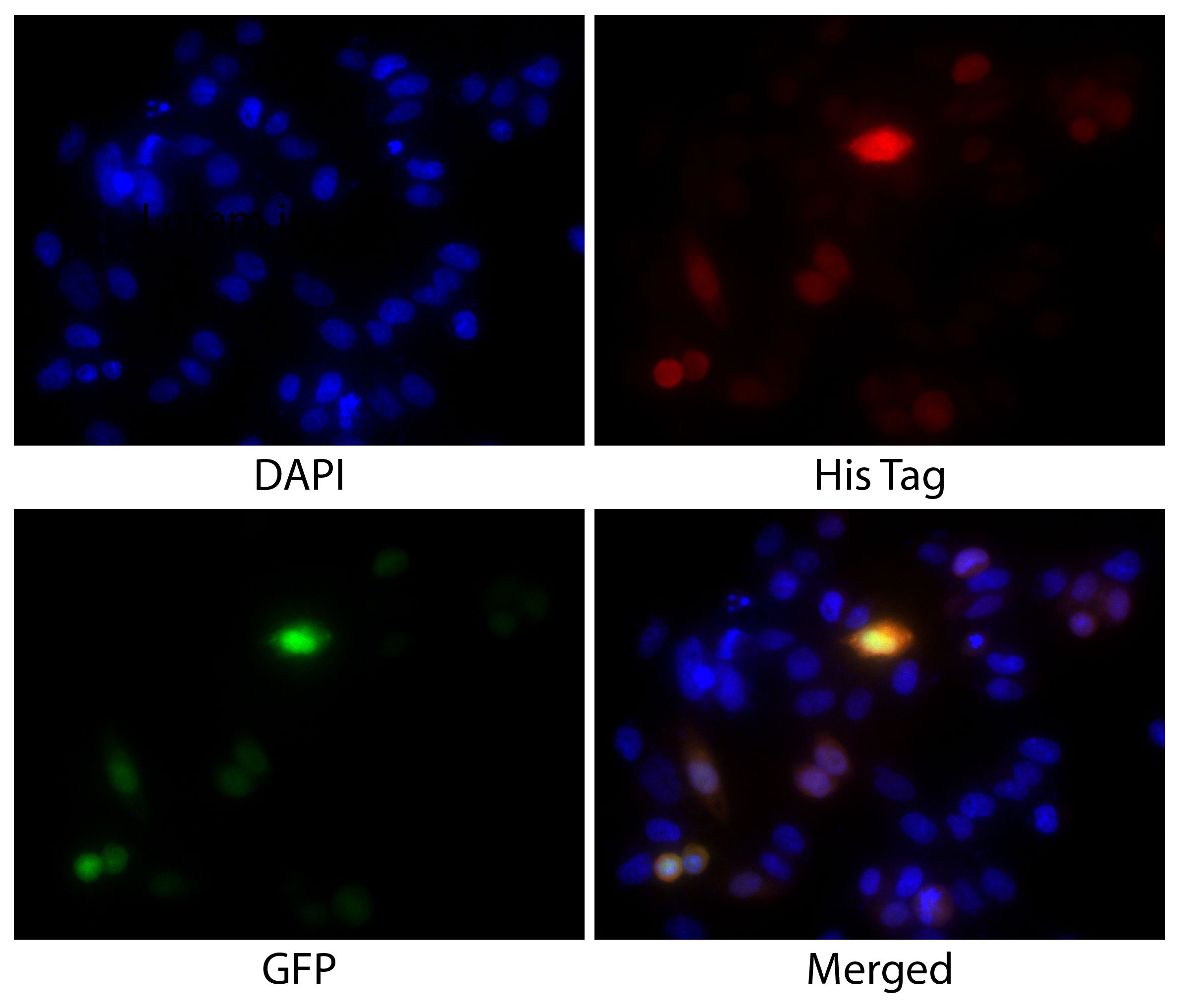 CHO-K1 cells transfected with GFP - N-terminal 6X His-tag were stained with Mouse Anti-His-Tag-BIOT (SB Cat. No. 4603-08) followed by Streptavidin-CY3 (SB Cat. No. 7100-12) and DAPI.