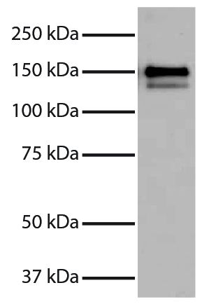 Purified Human Type I Collagen (SB Cat. No. 1200-01S) was resolved by electrophoresis, transferred to PVDF membrane, probed with Goat Anti-Type I Collagen-UNLB (SB Cat. No. 1310-01), and visualized using Donkey Anti-Goat IgG(H+L), Multi-Species SP ads-HRP (SB Cat. No. 6425-05) secondary antibody and chemiluminescent detection.