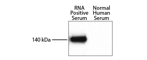 RNA helicase A (RHA) positive and normal human serum was resolved by electrophoresis, transferred to nitrocellulose membrane, and probed with anti-RHA followed by Goat F(ab')<sub>2</sub> Anti-Rabbit IgG(H+L), Mouse/Human ads-HRP (SB Cat. No. 4052-05) and chemiluminescent detection.<br/>Image from Vázquez-Del Mercado M, Palafox-Sánchez CA, Muñoz-Valle JF, Orozco-Barocio G, Oregon-Romero E, Navarro-Hernández RE, et al. High prevalence of autoantibodies to RNA helicase A in Mexican patients with systemic lupus erythematosus. Arthritis Res Ther. 2010;12:R6. Figure 1(b)<br/>Reproduced under the Creative Commons license https://creativecommons.org/licenses/by/2.0/