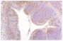 Paraffin embedded low pathogenic avian influenza virus infected lung tissue section was stained with Mouse Anti-Chicken Monocyte/Macrophage-UNLB (SB Cat. No. 8420-01) followed by a secondary antibody, DAB, and haematoxylin.<br/>Image from Rebel JM, Peeters B, Fijten H, Post J, Cornelissen J, Vervelde L. Highly pathogenic or low pathogenic avian influenza virus subtype H7N1 infection in chicken lungs: small differences in general acute responses. Vet Res. 2011;42:10. Figure 4(d)<br/>Reproduced under the Creative Commons license https://creativecommons.org/licenses/by/2.0/