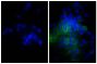 Human epithelial carcinoma cell line HEp-2 was stained with Mouse Anti-Human CD44-UNLB (SB Cat. No. 9400-01; right) followed by Goat Anti-Mouse IgG, Human ads-AF488 (SB Cat. No. 1030-30) and DAPI.