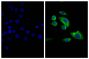 Human pancreatic carcinoma cell line MIA PaCa-2 was stained with Mouse Anti-Cytokeratin 18-UNLB (SB Cat. No. 10085-01; right) followed by Goat F(ab')<sub>2</sub> Anti-Mouse IgG<sub>2b</sub>, Human ads-FITC (SB Cat. No. 1092-02) and DAPI.