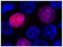 HEK293T cells transfected with p.G120C-mRFP-ICK were mounted with DAPI Fluoromount-G<sup>&reg;</sup> (SB Cat. No. 0100-20).<br/>Image from Oud MM, Bonnard C, Mans DA, Altunoglu U, Tohari S, Ng AY, et al. A novel ICK mutation causes ciliary disruption and lethal endocrine-cerebro-osteodysplasia syndrome. Cilia. 2016;5:8. Figure 2(a)<br/>Reproduced under the Creative Commons license https://creativecommons.org/licenses/by/4.0/