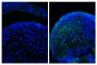 Frozen newborn mouse cartilage sections were blocked with Normal Rabbit Serum (SB Cat. No. 0040-01) and stained with Mouse Anti-Collagen Type II-UNLB (right) followed by Rabbit F(ab')<sub>2</sub> Anti-Mouse IgG(H+L), Human ads-BIOT (SB Cat. No. 6125-08), Streptavidin-CY2 (SB Cat. No. 7100-21), DAPI, and mounted with Fluoromount-G<sup>&reg;</sup> Anti-Fade (SB Cat. No. 0100-35).