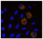Adherent cells of chicken PBMC were stained with Mouse Anti-Chicken Monocyte/Macrophage-PE (SB Cat. No. 8420-09) and anti-Ch-7TM followed by a secondary antibody and DAPI.<br/>Image from Chen YS, Wu HC, Shien JH, Chiu HH, Lee LH. Cloning and characterization of a 7 transmembrane receptor from the adherent cells of chicken peripheral blood mononuclear cells. PLoS One. 2014;9(1):e86880. Figure 4(a)<br/>Reproduced under the Creative Commons license https://creativecommons.org/licenses/by/4.0/
