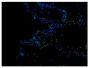 Frozen thermally burned mouse tissue section was stained with Rat Anti-Mouse CD11b-FITC (SB Cat. No. 1560-02S) and mounted with DAPI containing medium.<br/>Image from Everett J, Turner K, Cai Q, Gordon V, Whiteley M, Rumbaugh K. Arginine is a critical substrate for the pathogenesis of <i>Pseudomonas aeruginosa</i> in burn wound infections. MBio. 2017;8:e02160-16 Figure 1(c)<br/>Reproduced under the Creative Commons license https://creativecommons.org/licenses/by/4.0/