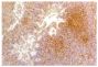 Paraffin embedded high pathogenic avian influenza virus infected lung tissue section was stained with Mouse Anti-Chicken Monocyte/Macrophage-UNLB (SB Cat. No. 8420-01) followed by a secondary antibody, DAB, and haematoxylin.<br/>Image from Rebel JM, Peeters B, Fijten H, Post J, Cornelissen J, Vervelde L. Highly pathogenic or low pathogenic avian influenza virus subtype H7N1 infection in chicken lungs: small differences in general acute responses. Vet Res. 2011;42:10. Figure 4(e)<br/>Reproduced under the Creative Commons license https://creativecommons.org/licenses/by/2.0/