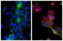 Human epithelial carcinoma cell line HEp-2 was stained with Mouse Anti-Cytokeratin 18-UNLB (SB Cat. No. 10085-01; right) and Mouse Anti-Human CD44-FITC (SB Cat. No. 9400-02) followed by Goat Anti-Mouse IgG<sub>2b</sub>, Human ads-TRITC (SB Cat. No. 1090-03) and DAPI.
