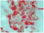 Human pancreatic carcinoma cell line MIA PaCa-2 was stained with Mouse Anti-Cytokeratin 8-UNLB (SB Cat. No. 10080-01) followed by Goat Anti-Mouse IgG<sub>2a</sub>, Human ads-AP (SB Cat. No. 1080-04), Red AP, and mounted with Fluoromount-G<sup>&reg;</sup> (SB Cat. No. 0100-01).