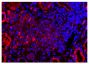 Paraffin embedded human kidney section from AAV patient was stained with anti-C5L2 followed by Goat Anti-Rabbit IgG(H+L), Mouse/Human ads-TRITC (SB Cat. No. 4050-03) and DAPI.<br/>Image from Yuan J, Gou S, Huang J, Hao J, Chen M, Zhao M. C5a and its receptors in human anti-neutrophil cytoplasmic antibody (ANCA)-associated vasculitis. Arthritis Res Ther. 2012;14:R140. Figure 3(c)<br/>Reproduced under the Creative Commons license https://creativecommons.org/licenses/by/2.0/
