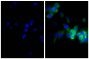 Human pancreatic carcinoma cell line MIA PaCa-2 was stained with Mouse Anti-Cytokeratin 18-UNLB (SB Cat. No. 10085-01; right) followed by Goat Anti-Mouse Kappa-BIOT (SB Cat. No. 1050-08), Streptavidin-FITC (SB Cat. No. 7100-02), and DAPI.