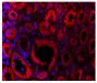 Paraffin embedded human kidney section from AAV patient was stained with anti-C5L2 followed by Goat Anti-Rabbit IgG(H+L), Mouse/Human ads-TRITC (SB Cat. No. 4050-03) and DAPI.<br/>Image from Yuan J, Gou S, Huang J, Hao J, Chen M, Zhao M. C5a and its receptors in human anti-neutrophil cytoplasmic antibody (ANCA)-associated vasculitis. Arthritis Res Ther. 2012;14:R140. Figure 4(a)<br/>Reproduced under the Creative Commons license https://creativecommons.org/licenses/by/2.0/
