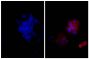Human epithelial carcinoma cell line HEp-2 was stained with Mouse Anti-Human CD44-UNLB (SB Cat. No. 9400-01; right) followed by Goat Anti-Mouse IgG, Human ads-AF555 (SB Cat. No. 1030-32) and DAPI.