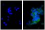 Human pancreatic carcinoma cell line MIA PaCa-2 was stained with Mouse Anti-Cytokeratin 18-UNLB (SB Cat. No. 10085-01; right) followed by Goat Anti-Mouse Kappa-FITC (SB Cat. No. 1050-02) and DAPI.