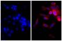 Human pancreatic carcinoma cell line MIA PaCa-2 was stained with Mouse Anti-Cytokeratin 18-UNLB (SB Cat. No. 10085-01; right) followed by Goat Anti-Mouse IgG(H+L), Multi-Species SP ads-AF555 (SB Cat. No. 1038-32) and DAPI.
