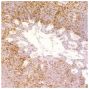 Paraffin embedded high pathogenic avian influenza virus infected lung section was stained with Mouse Anti-Chicken CD8α-UNLB (SB Cat. No. 8220-01) followed by a secondary antibody, DAB, and haematoxylin.<br/>Image from Rebel JM, Peeters B, Fijten H, Post J, Cornelissen J, Vervelde L. Highly pathogenic or low pathogenic avian influenza virus subtype H7N1 infection in chicken lungs: small differences in general acute responses. Vet Res. 2011;42:10. Figure 4(c)<br/>Reproduced under the Creative Commons license https://creativecommons.org/licenses/by/2.0/